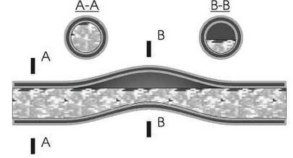 Air can accumulate in pipe bends